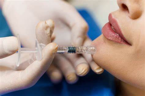 Các Yếu Tố Ảnh Hưởng Đến Thời Gian Tiêm Filler Cằm Đạt Kết Quả Đẹp