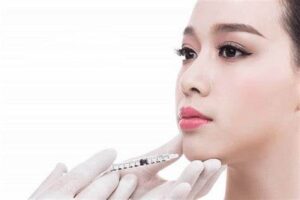 Tiêm Filler Cằm Bao Lâu Thì Đẹp?