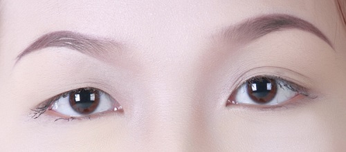 Mắt một bên 2 mí một bên 1 mí là gì?