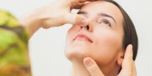 Nâng mũi bị bao xơ - Dấu hiệu nhận biết